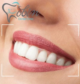 کامپوزیت دندان چیست و چه مزایایی دارد؟